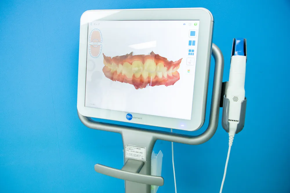 3D光学スキャナー「iTero（アイテロ）」を導入